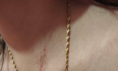 แม่จันคลิปกระฉ่อนหนุ่มอาข่าทะเลาะสาวลีซอทุบด้วยเก้าอี้ปมเงิน17,000 บาท ต่างฝ่ายอ้างไปคนละทาง