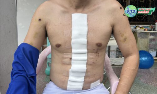 เชียงราย – อุกอาจ! ยิงเพื่อนสนิทหน้าเซเว่นฯ แม่จัน ปมชกต่อย 4 เดือนก่อน ตร.บุกถึงบ้าน พบยาบ้า-ปืนเถื่อน